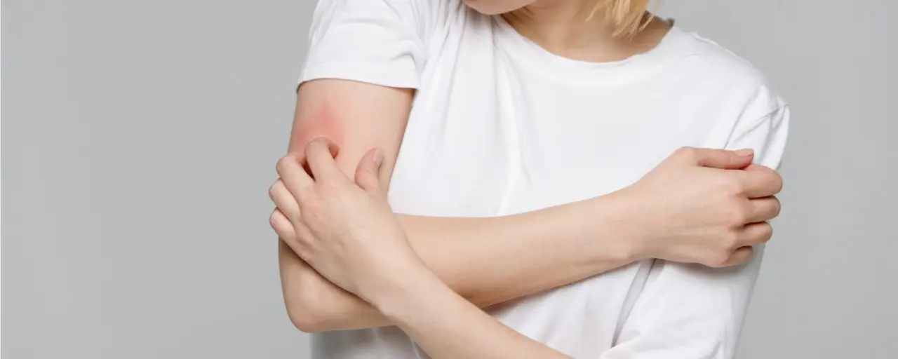 Falsa scabbia: i segnali che non dovresti sottovalutare