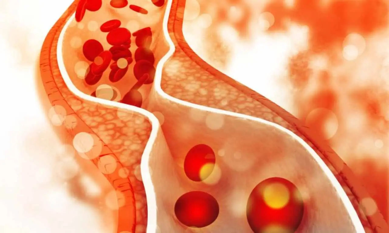 Come mantenere pulite le tue arterie e prevenire i problemi cardiovascolari